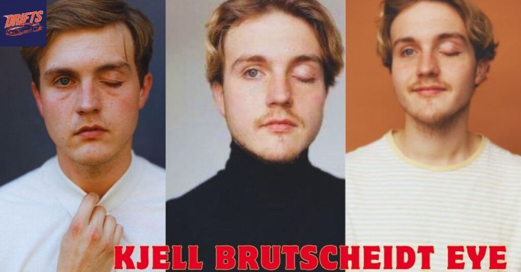 Kjell Brutscheidt Bio & Career (4)